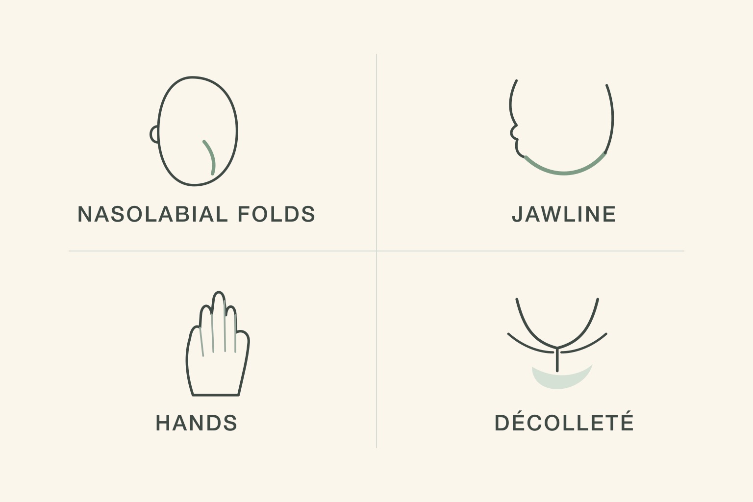 Diagram of the four areas Radiesse is approved to treat — nasolabial folds, jawline, hands and décolleté
